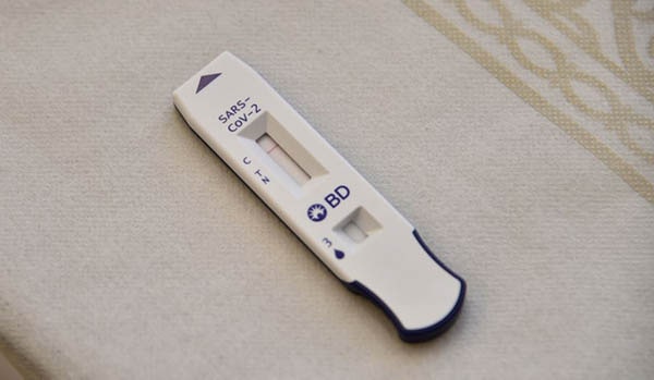 Israele: centri per i test rapidi Covid19 a livello nazionale