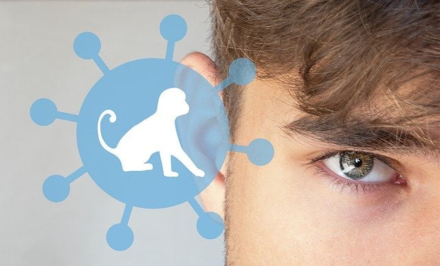 Vaiolo delle scimmie, a breve saranno disponibili le vaccinazioni